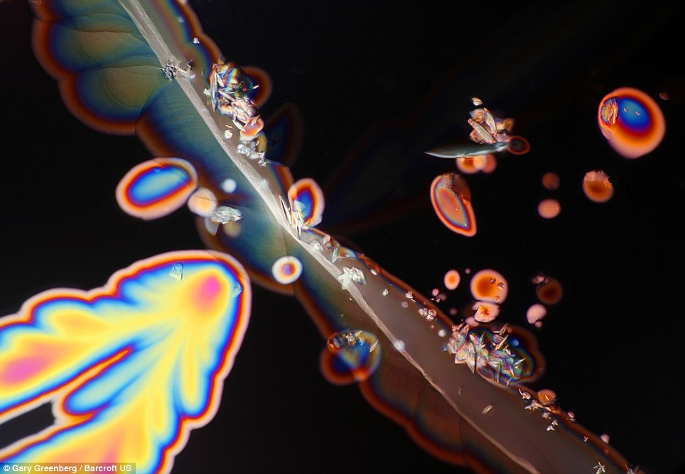 تصاویری از نمای سه‌بعدی غذاهای معمولی در زیر میکروسکوپ!!  
