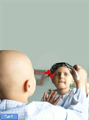 عکسی در حمایت از کودکان سرطانی 
