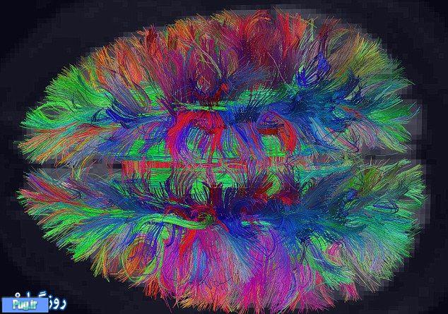 تصاویری از نقشه مغز انسان 