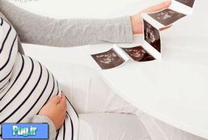 نکاتی جالب توجه برای خانم های باردار