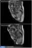 نخستين تصاوير MRI‌ از لحظه تولد نوزاد+عکس 