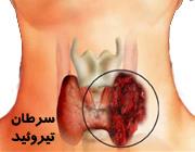 آموزش سگ ها برای تشخیص سرطان تیروئید