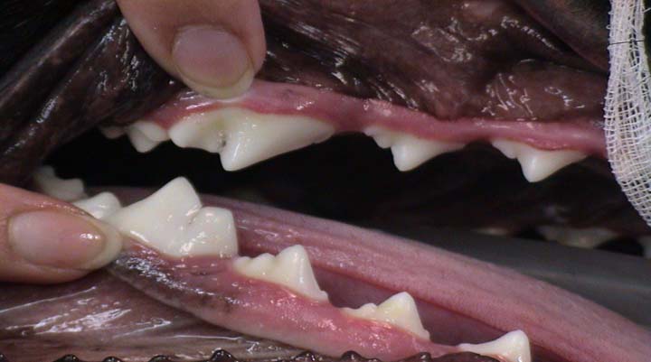 بهداشت دهان و دندان جرم گیری با دستگاه اولتراسونیک 